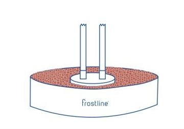 Frostline terasse-forhøjningssæt